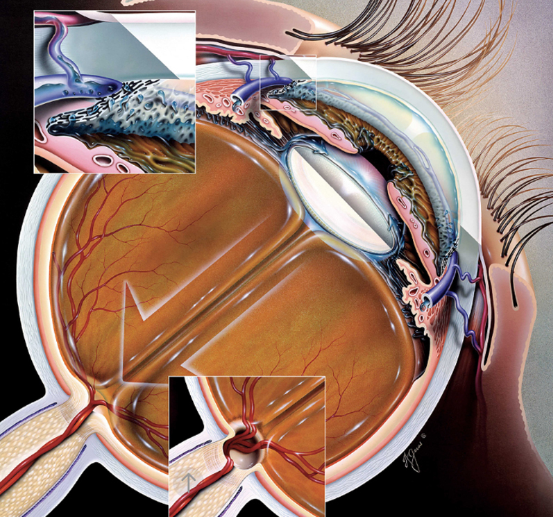 Лечение глаз при помощи гимнастики thumbnail
