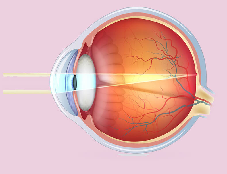 Упражнения для укрепления мышц глаз и улучшения зрения