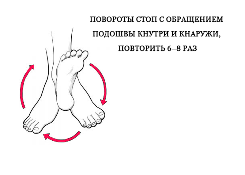 Как выглядит варикоз картинки