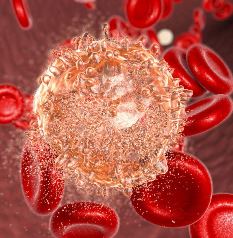 Лейкемия: Симптомы рака крови, которые часто игнорируют