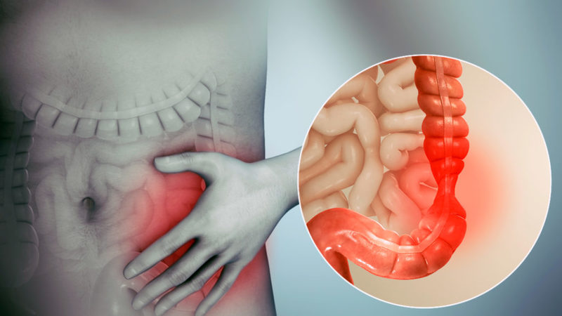 Что можно есть при синдроме раздраженного кишечника?