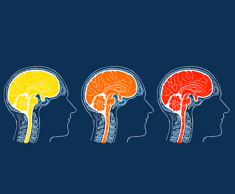 3 упражнения для мозга, которые нейрохирурги советуют выполнять всем