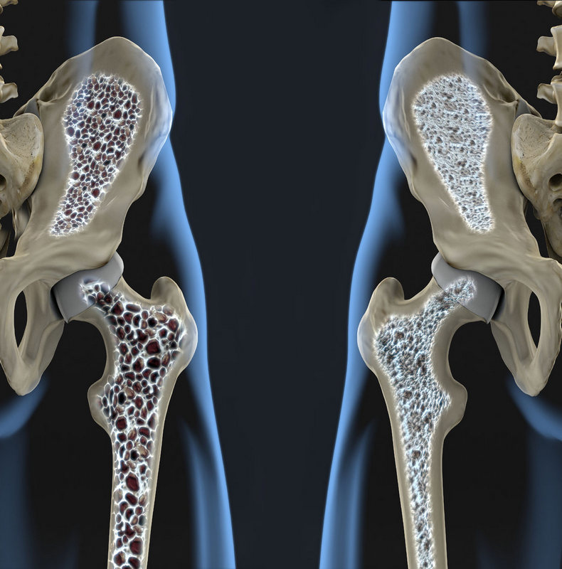 Хрупкие отношения: Как остеопороз связан с работой кишечника