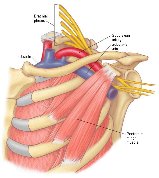 Синдром малой грудной мышцы – причина болезненности, онемения и отека рук