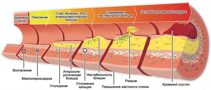 Холестерин на веках фото