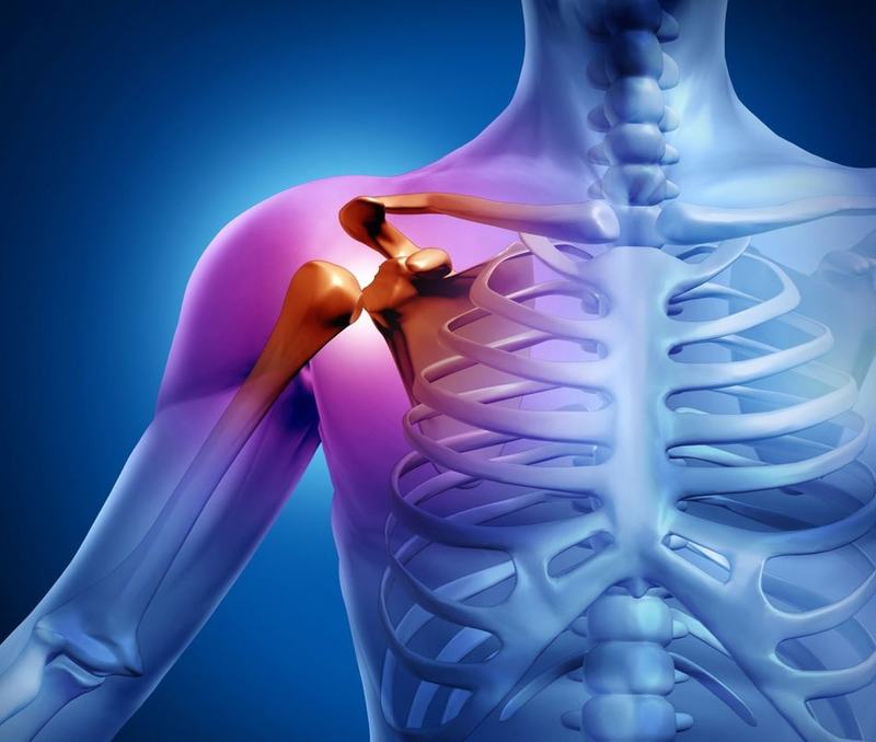 Плечевой тендинит: 6 упражнений от боли в плече
