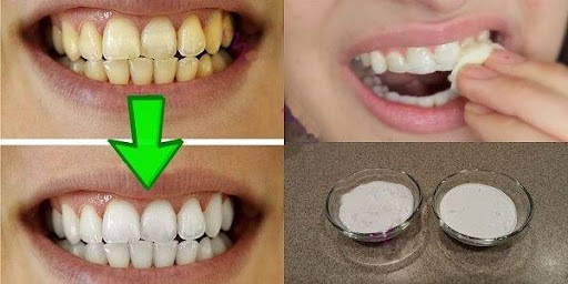 Рецепт для отбеливания зубов - всего 2 минуты