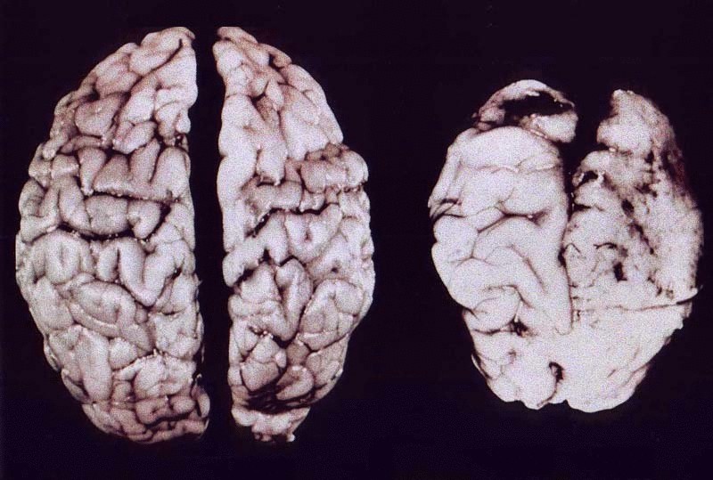 Как действуют наркотики на головной мозга как сделать анашу из конопли